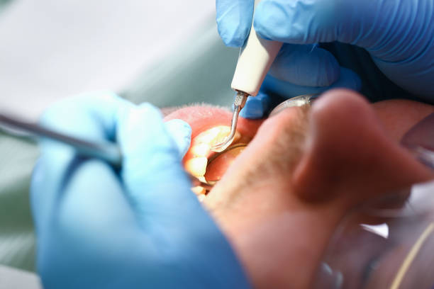 Best Broken or Cracked Tooth Emergency Dentist in Suitland, MD