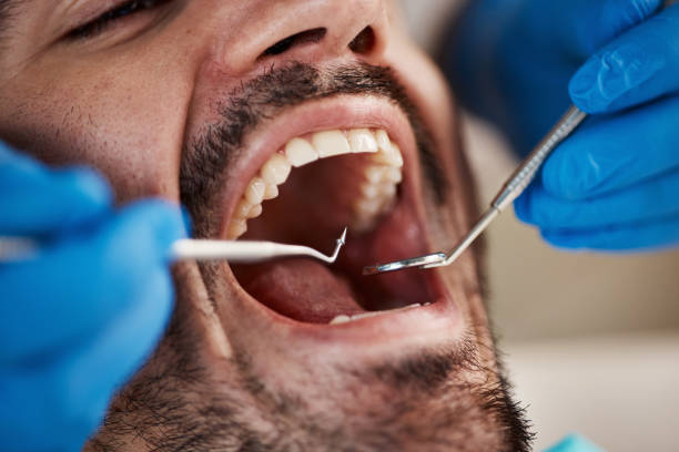 Best Mobile Emergency Dentist in Suitland, MD