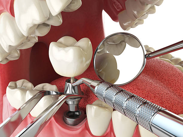 Best Urgent Dental Care for Toothache in Suitland, MD